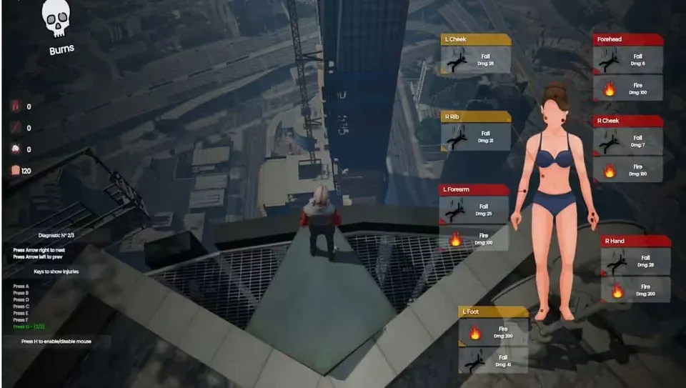 Body Damages V2 [ ESX / QBCore / STANDALONE ] FiveM resource preview