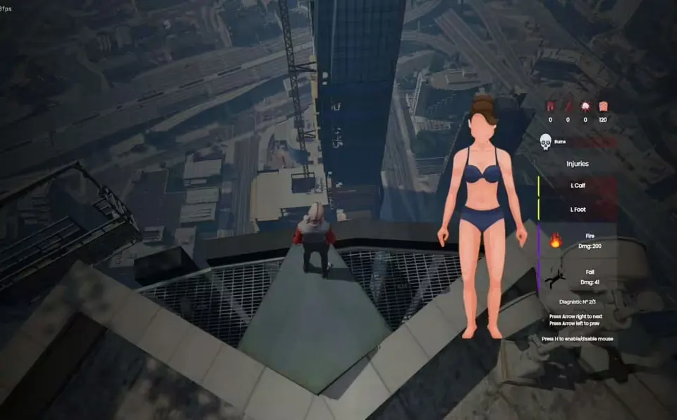 Body Damages V2 [ ESX / QBCore / STANDALONE ] FiveM resource preview 2